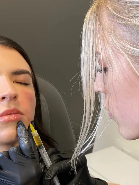 Aesthetician performing lip filler injection on female client in Brookfield, WI | Luna Med Spa