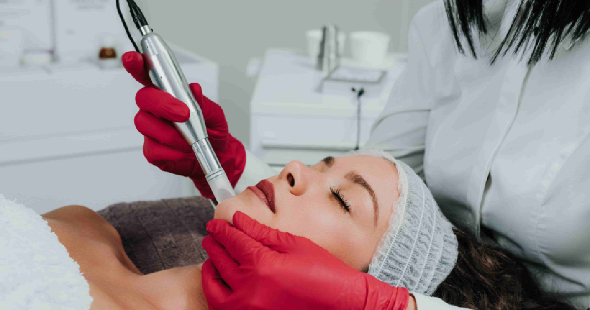A female cosmetologist in red gloves performs a Microneedling & Sylfirm X cosmetic procedure on a patient in Brookfield, WI.