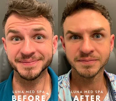 boy-face-before-after