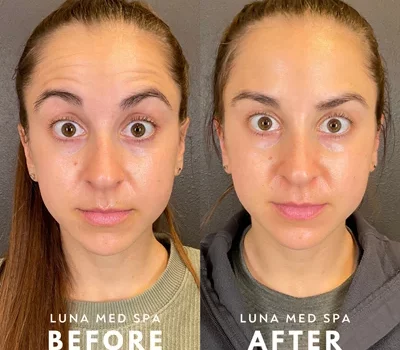 women-face-tox by lunamedspaw in Brookfield, WI